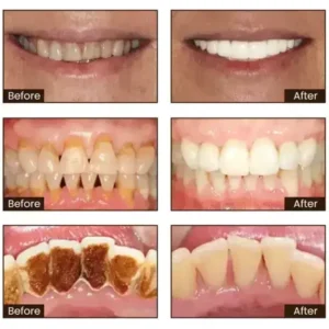 SmileFitPro™ Niacinamide Whitening Toothpaste