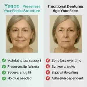 Yagoo™ Medical Full Denture with Strong Suction