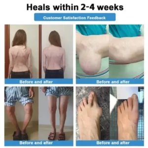 ✅ Official Store: Skavix® Nano-Microneedle Joint Patch