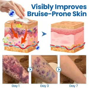 Virexo™ Fragile Skin Repair Cream