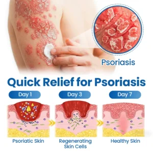 Virexo™ Fragile Skin Repair Cream