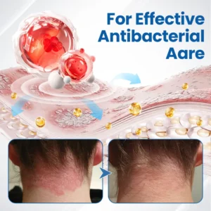 Virexo™ Fragile Skin Repair Cream