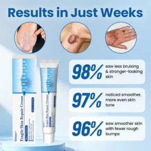 Virexo™ Fragile Skin Repair Cream