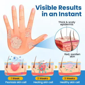 Virexo™ Fragile Skin Repair Cream