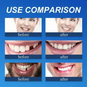 Ends Today: 70% OFF! ⏰70% OFF! FOMONEST™ Medical Full Denture with Strong Suctiond Custom-Fit Full Functional Dentures