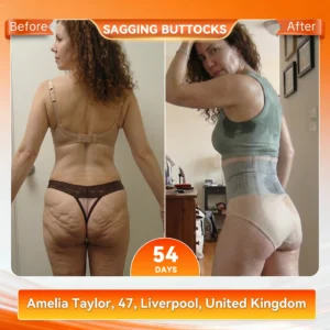 Fumepure® 2026 NEW RELEASE Moringa & Berberine 4‑In‑1 Micro‑Particle Sculpting & Fat‑Burn Shorts