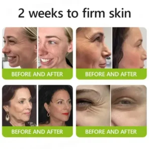 Lunaraé™ Botox & Retinol Shot