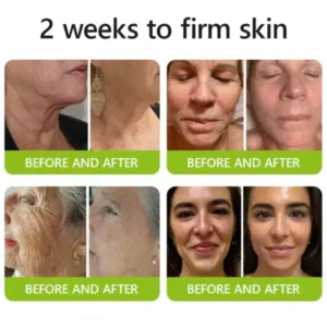 Lunaraé™ Botox & Retinol Shot