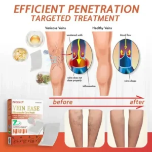 Zvoevo® Vein Ease Microneedle Care Patch