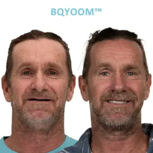 BQYOOM™ GelFit Dentures