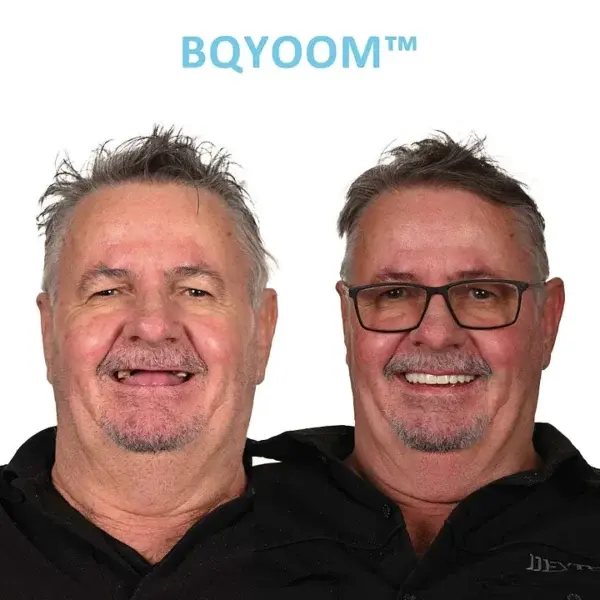 BQYOOM™ GelFit Dentures